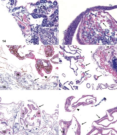 Multifocal Pink Discoloration Porites Sp Fig Note Filaments Of