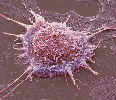 Cervical Cancer Cell Sem Photograph By Steve Gschmeissner Pixels