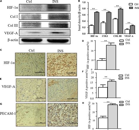 Frontiers Insulin Containing Wound Dressing Promotes Diabetic Wound