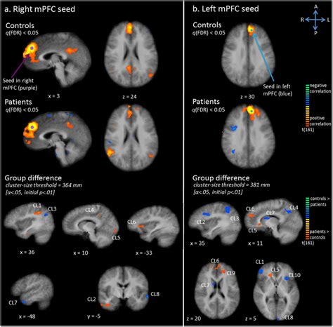 Functional Connectivity Fc Maps For The Medial Prefrontal Cortex