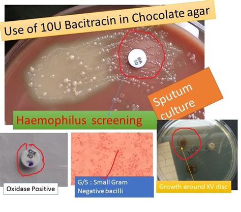 Bacitracin Test Principle Procedure And Expected Results