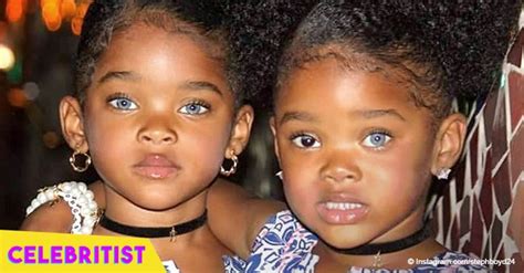 Blue Eyed Twins Who Were The Most Beautiful Twins In The World Are