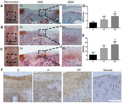 Histological Evaluation Of In Vivo Cartilage Regeneration Of The