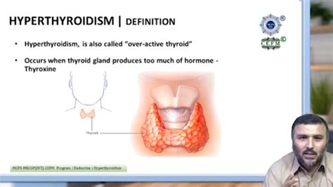 SOLUTION Hyperthyroidism Pathophysiology General Medicine Mcps Studypool