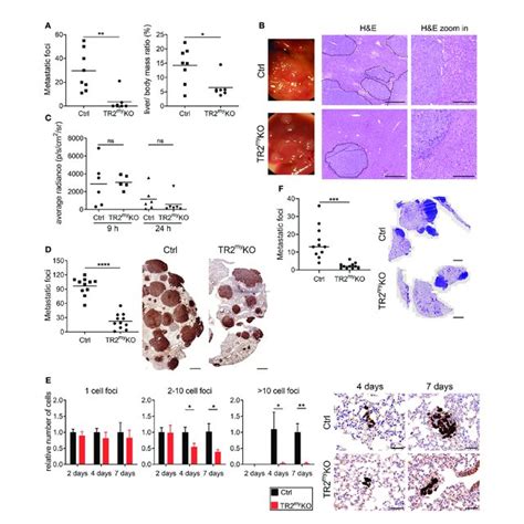 Reduced Myeloid Cell Recruitment To Liver Metastatic Foci In