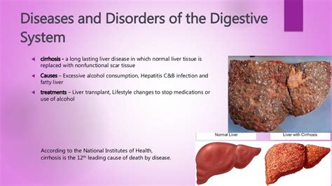 Overview Of The Digestive System And Diseases Of It