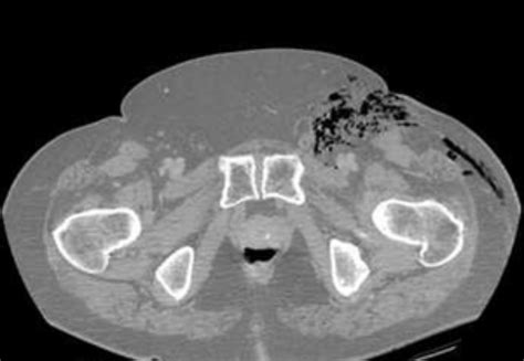 Radrounds Radiology Network On Twitter Diabetic Patient Presents