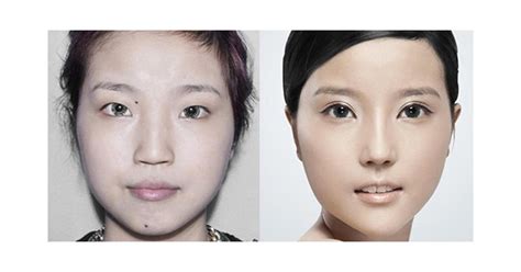 Extreme Plastic Surgery Causes Passport Confusion Popsugar Beauty Photo 4