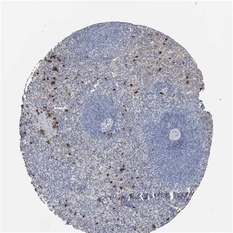 Tissue Expression Of CD38 Staining In Spleen The Human Protein Atlas