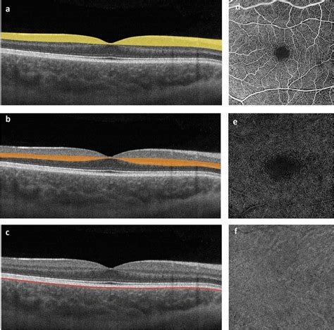 Anatomic Localisation And Segmentation Boundaries Of The Vascular