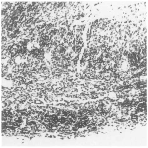 Plate 8 Thymus Of A Male Swiss Cd 1® Mouse Given 400 Mg Azt 640 Mg Rifabutin Per Kg Body