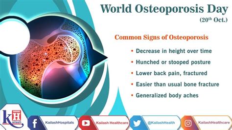 Osteoporosis Often Considered A Silent Bone Disease Doesnt Show Any