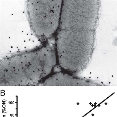 (PDF) Proteus mirabilis and Urinary Tract Infections