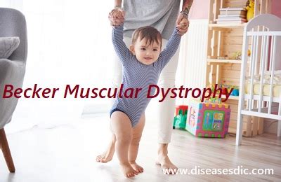 Becker Muscular Dystrophy – Risk Factors, Causes, and Diagnosis.