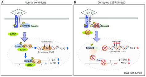 Schematic Model Of Disrupted Tgf β Signaling And Bws Tumorigenesis A