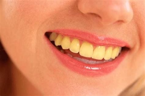 How To Have White Teeth At Home In Just 3 Minutes