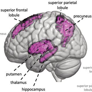 Brain Renderings Of Rich Club Regions As Defined In Work By Van Den