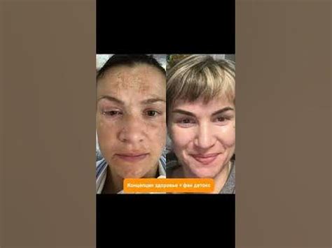Фан детокс Коралловый клуб - почисти свою печень - YouTube