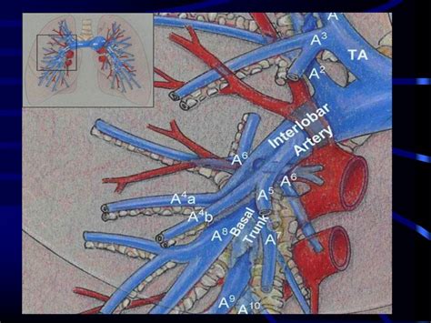 Pulmonary Artery Anatomy and Pulmonary Embolism