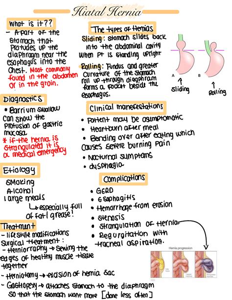 Med Surg Study Guides Hitial Hernia Hiatal Hernia What Is It