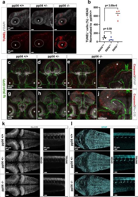 Ppil4 Zebrafish Exhibit Apoptosis In Neurons And Radial Glia But