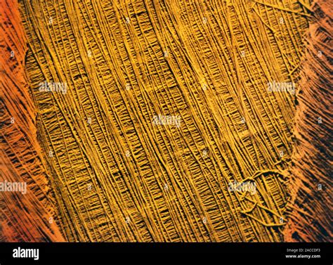 Algae cell wall. Coloured scanning electron micrograph (SEM) of ...