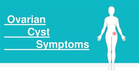 Ovarian Cyst Symptoms| Symptoms of Ovarian Cyst