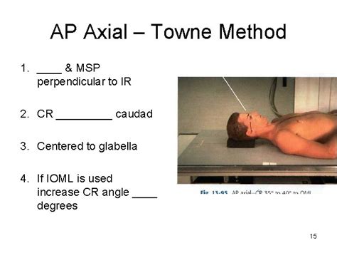 Mandible TMJ Lecture RT 233 Week 7 FINAL