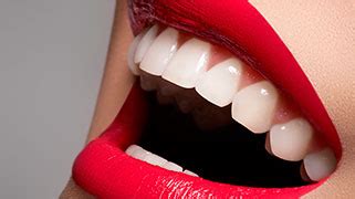 Tratamento Clareamento Dental Consulta Ideal