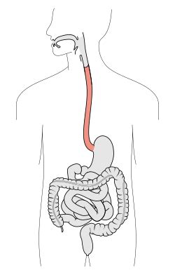 esophagus libre pathology