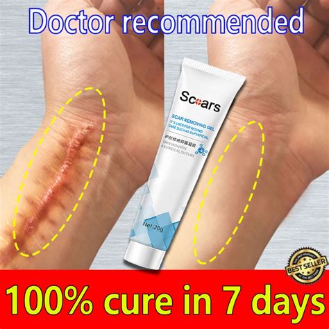 Scar Remover Peklat For Old And New Scar Scarminator Cream Strech Mark