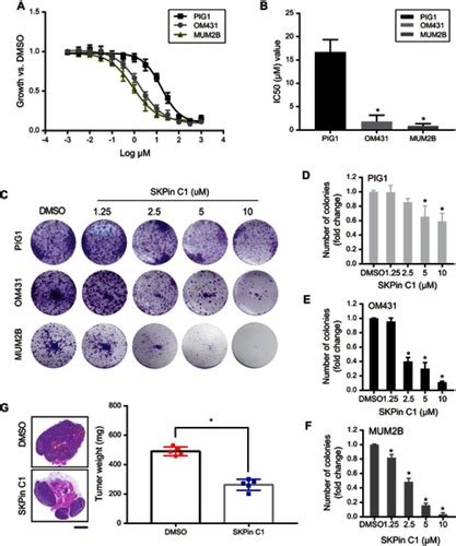 Full Article Skp Targeted Inhibition Suppresses Human Uveal Melanoma