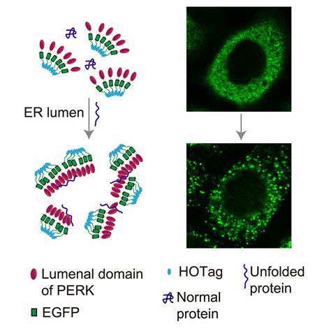 Deciphering ER Stress Unfolded Protein Response Relationship By