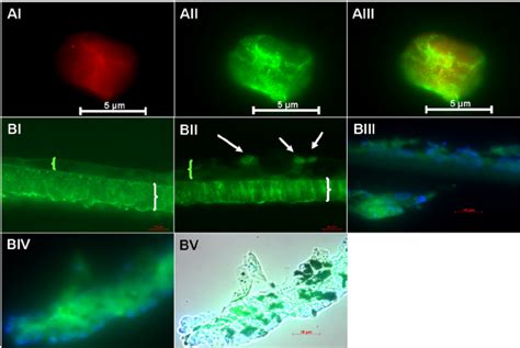 A A Cytospin Preparation From The Basal Cell Culture Medium That