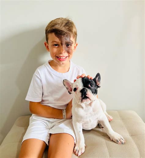 Parents Gift Son With a Unique Birthmark a Dog That Looks Exactly Like Him