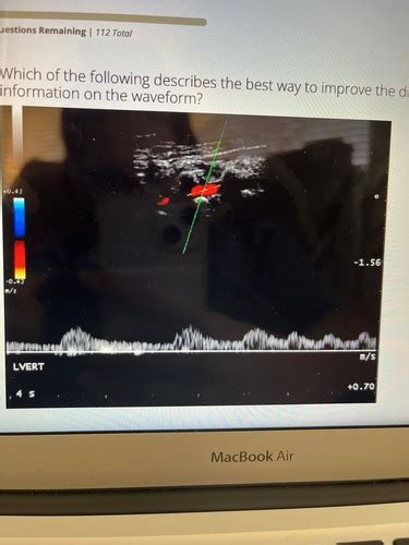 SPI Doppler Imaging Concepts 31 PT 1 Flashcards Quizlet