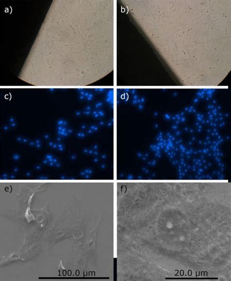 Optical Micrograph Of The Proliferation Of Osteoblast Primary A