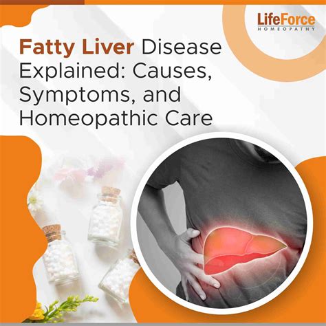 Causes, Symptoms of Fatty Liver And Homeopathy Treatments