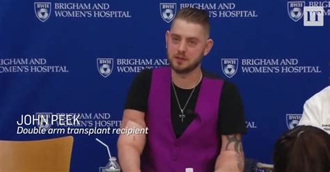 US Marine veteran receives bilateral arm transplant – The Irish Times