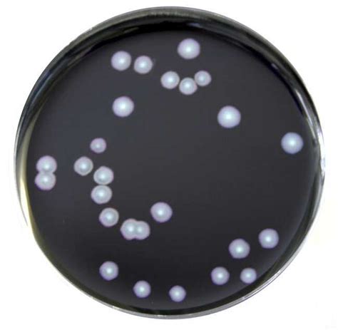 Legionella Paolocliodhna