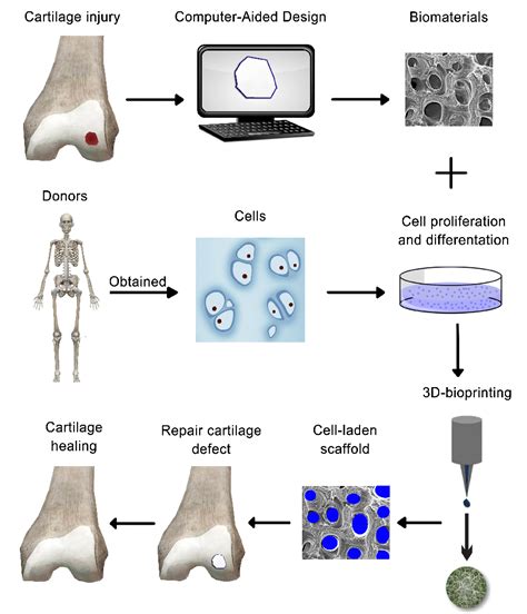 Figure 1 From Applications Of Biocompatible Scaffold Materials In Stem Cell Based Cartilage