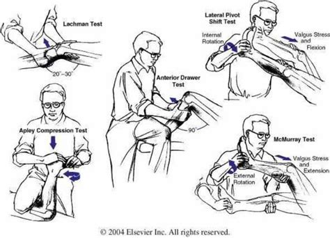 normal knee physical exam template printable forms