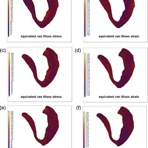 Colour Coded Maps Of Von Mises Equivalent Stress Left In Kpa And