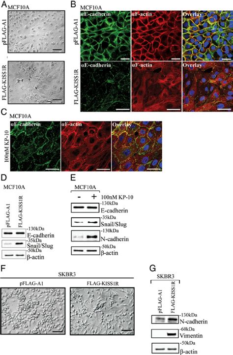 KISS1R Expression Induces A Partial EMT Like Phenotype In Nonmalignant