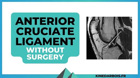 Anterior Cruciate Ligament Treatment Without Surgery Acl Rehab