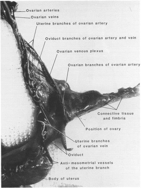 Close Up Photograph Of The Ovarian Vasculature Within 2 Cm Of The