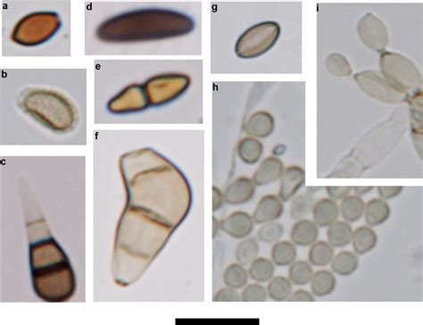 Images Of Common Fungal Spores Sampled At The Different Heights Over