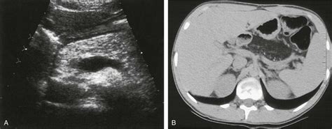 The Pancreas Radiology Key