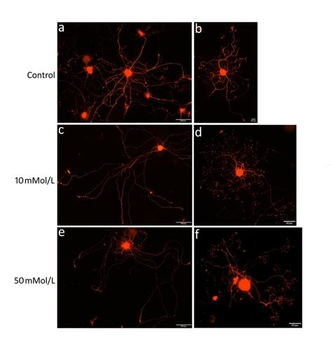 Examples Of Neurite Degeneration In Urea Treated Neurons PGP9 5