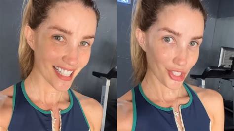 Aline Gotschalg Celebra Volta Da Fala Ap S Paralisia Das Cordas Vocais